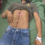 हाथरस: क्लीनिक में घुसकर बदमाशों ने की फायरिंग, संचालक गंभीर रूप से घायल