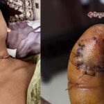 अलीगढ़ के शमशाद पुल पर चाइनीज़ मांझे से बड़ा हादसा, दिनेश राजपूत गंभीर घायल, जेएन मेडिकल में भर्ती
