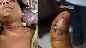 अलीगढ़ के शमशाद पुल पर चाइनीज़ मांझे से…
