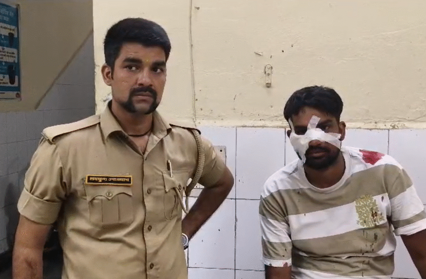 अलीगढ़ में चाइनीज मांजे का कहर,शिक्षक की नाक-गाल कटे, भाई को स्टेशन लेने जाते समय हुआ हादसा
