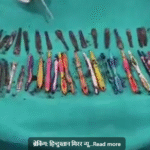 हापुड़ में चौंकाने वाला मामला: नशे के आदी सचिन के पेट से 29 स्टील चम्मच 19 टूथब्रश, 2 नुकीले पेन सहित कुल 50 वस्तुएं निकली हैं!!