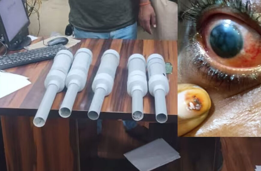 कार्बाइड गन से दीवाली में 150 लोगों की रोशनी चली, कई गंभीर रूप से जख्मी