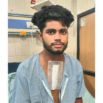 जेएन मेडिकल कॉलेज के सर्जनों ने खतरनाक छाती की चोट से जूझ रहे किशोर की जान बचाई